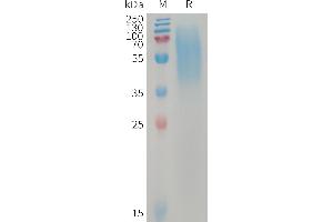 LY6/PLAUR Domain Containing 3 (LYPD3) (AA 31-286) protein (His tag)