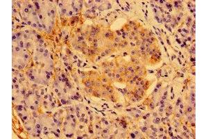 Immunohistochemistry of paraffin-embedded human pancreatic tissue using ABIN7166602 at dilution of 1:100 (PSORS1C1 antibody  (AA 1-152))