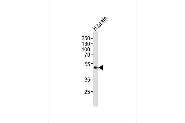 Kir2.2 antibody  (C-Term)