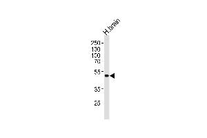 Kir2.2 anticorps  (C-Term)