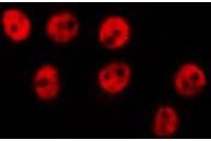 ABIN6275630 staining HepG2 by IF/ICC. (TIGD1 antibody  (Internal Region))