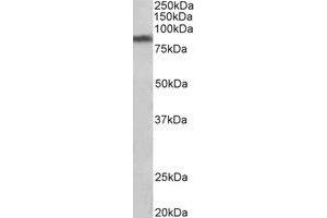Western Blotting (WB) image for anti-Solute Carrier Family 6 (Neurotransmitter Transporter, Dopamine), Member 3 (SLC6A3) (Internal Region) antibody (ABIN2465033) (SLC6A3 antibody  (Internal Region))