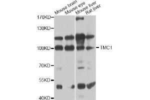 Western blot analysis of extracts of various cell lines, using TMC1 antibody (ABIN6293566) at 1:1000 dilution. (TMC1 antibody)