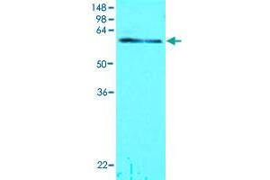 Cell lysates of MCF-7 (30 ug) were resolved by SDS-PAGE, transferred to NC membrane and probed with TDP1 monoclonal antibody, clone AT1F2  (1 : 1000). (TDP1 antibody  (AA 1-298))