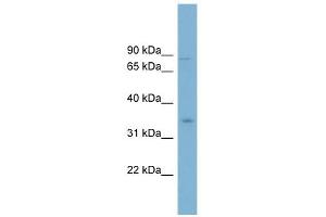 GPD2 antibody used at 1 ug/ml to detect target protein. (GPD2 antibody)