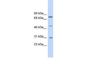 WB Suggested Anti-EGR3 Antibody Titration:  0. (EGR3 antibody  (Middle Region))
