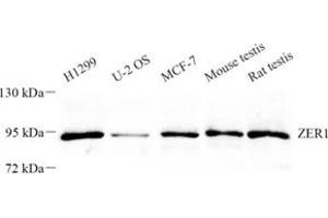Western blot analysis of ZER1 (ABIN7076289) at dilution of 1: 500 (ZER1 antibody)