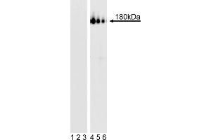Western Blotting (WB) image for anti-Platelet Derived Growth Factor Receptor beta (PDGFRB) (pTyr857) antibody (ABIN967592) (PDGFRB antibody  (pTyr857))