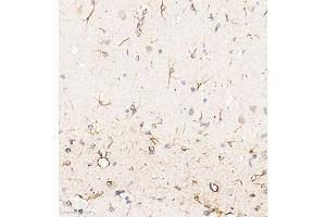 Immunohistochemistry of paraffin embedded rat brain using ACyclaseI (ABIN7072958) at dilution of 1:650 (300x lens) (ADCY1 antibody)