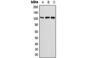 Western blot analysis of ETAA1 expression in U2OS (A), MCF7 (B), PC12 (C) whole cell lysates.