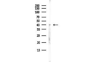 anti-Glutaminyl-Peptide Cyclotransferase-Like (QPCTL) antibody