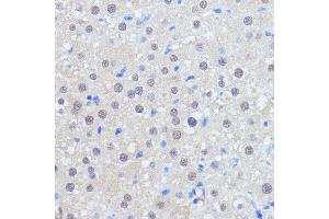 Immunohistochemistry of paraffin-embedded rat liver using RBM39 antibody (ABIN7270085) at dilution of 1:100 (40x lens). (RBM39 antibody  (C-Term))