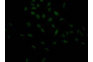 Immunofluorescence (IF) image for anti-Hypoxia Inducible Factor 1, alpha Subunit (Basic Helix-Loop-Helix Transcription Factor) (HIF1A) antibody (ABIN7127542)