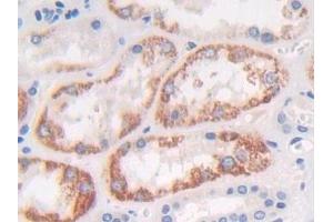 Detection of FGFRL1 in Human Kidney Tissue using Polyclonal Antibody to Fibroblast Growth Factor Receptor Like Protein 1 (FGFRL1) (FGFRL1 antibody  (AA 168-378))