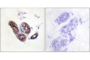 Immunohistochemistry analysis of paraffin-embedded human skin tissue, using MITF (Ab-180/73) Antibody. (MITF antibody  (AA 151-200))