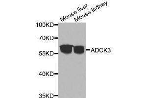 Western blot analysis of extracts of various cell lines, using ADCK3 antibody (ABIN5975514) at 1/1000 dilution. (COQ8A antibody)