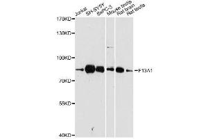 Western blot analysis of extracts of various cell lines, using F13A1 antibody. (F13A1 antibody  (AA 600-732))