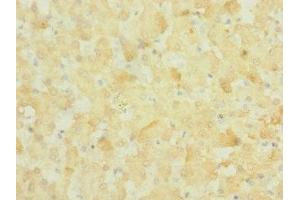 Immunohistochemistry of paraffin-embedded human liver tissue using ABIN7161008 at dilution of 1:100 (NOX3 antibody  (AA 223-395))