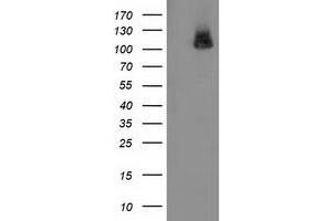 Western Blotting (WB) image for anti-phosphodiesterase 2A, CGMP-Stimulated (PDE2A) antibody (ABIN1500080) (PDE2A antibody)
