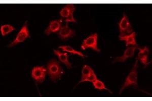 ABIN6275062 staining HT29 by IF/ICC. (GNPAT antibody  (Internal Region))