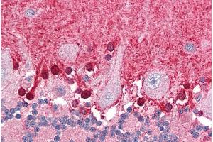 ABIN184640 (3. (ABTB1 antibody  (C-Term))