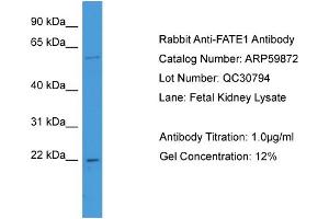 WB Suggested Anti-FATE1  Antibody Titration: 0. (FATE1 antibody  (N-Term))