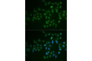 Immunofluorescence analysis of U2OS cells using MYLK3 antibody (ABIN6129615, ABIN6144266, ABIN6144267 and ABIN6222364). (MYLK3 antibody  (AA 1-240))