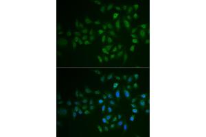 Immunofluorescence analysis of U2OS cells using MYLK3 antibody (ABIN6129615, ABIN6144266, ABIN6144267 and ABIN6222364). (MYLK3 antibody  (AA 1-240))
