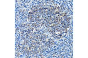 Immunohistochemistry of paraffin-embedded Mouse spleen using Alpha-tubulin (ubiquitous) chain antibody (ABIN7271033) at dilution of 1:50 (40x lens). (TUBA1B antibody  (AA 1-451))