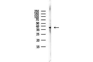anti-Proline Arginine Rich End Leucine Rich Repeat Protein (PRELP) antibody