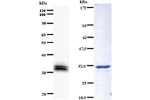 Left: YEATS4 staining. (GAS41 antibody)