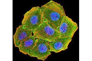 Immunocytochemistry (ICC) image for anti-Cyclin D1 (CCND1) (AA 167-295) antibody (ABIN5862106) (Cyclin D1 antibody  (AA 167-295))