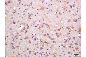 Formalin-fixed and paraffin embedded rat brain labeled with Rabbit Anti HSP10/CPN10 Polyclonal Antibody, Unconjugated (ABIN721885) at 1:200 followed by conjugation to the secondary antibody and DAB staining (HSPE1 antibody  (AA 51-102))