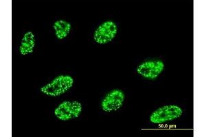 Immunofluorescence of monoclonal antibody to DLL1 on HeLa cell. (DLL1 antibody  (AA 18-109))