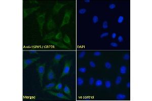 ABIN5539777 Immunofluorescence analysis of paraformaldehyde fixed HeLa cells, permeabilized with 0. (GRP78 antibody  (Internal Region))