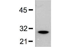 1:5000 (0. (GST antibody)