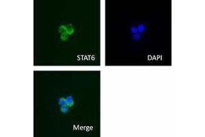 Immunofluorescence (IF) image for anti-Signal Transducer and Activator of Transcription 6, Interleukin-4 Induced (STAT6) antibody (ABIN2666296) (STAT6 antibody)