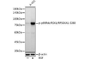 Western blot analysis of extracts of A-431 cells, using Phospho-p90Rsk/RSK1/RPS6K-S380 antibody (ABIN7270036) at 1:1000 dilution. (RPS6KA1 antibody  (pSer380))