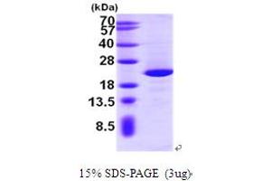 SDS-PAGE (SDS) image for Nuclear Import 7 Homolog (NIP7) (AA 1-180) protein (His tag) (ABIN666988)