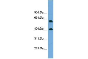 WB Suggested Anti-TERF2IP Antibody Titration: 0. (RAP1 antibody  (Middle Region))