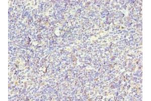 Immunohistochemistry of paraffin-embedded human thymus tissue using ABIN7169003 at dilution of 1:100 (STK38L antibody  (AA 212-464))