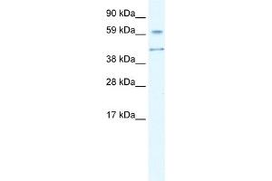 WB Suggested Anti-AIRE Antibody Titration:  0. (AIRE antibody  (N-Term))
