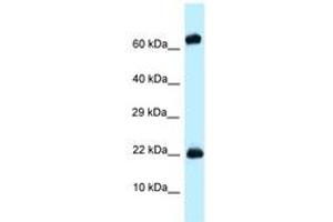 Image no. 1 for anti-Zinc Finger Protein 580 (ZNF580) (AA 58-107) antibody (ABIN6748023)