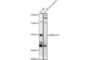 Western blot analysis of extracts of A-549 cells, using RA/B antibody (ABIN7269790) at 1:1000 dilution. (RAB11A antibody)