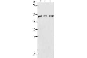 Western Blotting (WB) image for anti-Poly (ADP-Ribose) Polymerase 1 (PARP1) antibody (ABIN2432195) (PARP1 antibody)