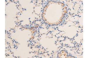 Immunohistochemistry (IHC) image for anti-serum/glucocorticoid Regulated Kinase 1 (SGK1) (pSer422) antibody (ABIN6256329)