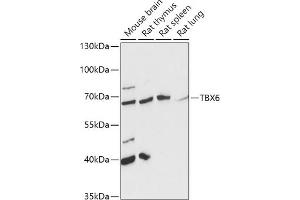 Western blot analysis of extracts of various cell lines, using TBX6 antibody (ABIN7270702) at 1:1000 dilution. (T-Box 6 antibody  (AA 191-300))