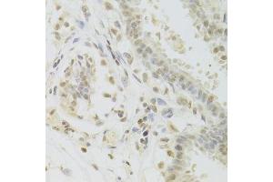 Immunohistochemistry of paraffin-embedded human breast using PRPF3 Antibody.