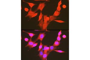 Immunofluorescence analysis of NIH-3T3 cells using Phospho-PDK1/PDPK1-S241 Rabbit pAb (ABIN6135282, ABIN6136186, ABIN6136187 and ABIN6225525) at dilution of 1:100 (40x lens). (PDPK1 antibody  (pSer241))