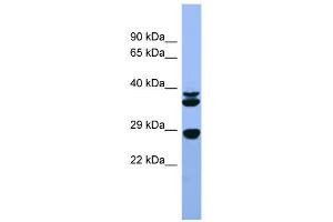 WB Suggested Anti-Fgf3 Antibody Titration:  0. (FGF3 antibody  (C-Term))